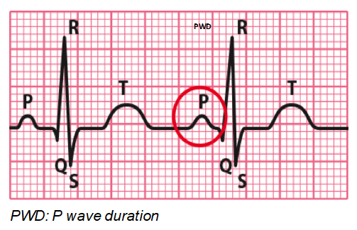 image-P Wave Duration.PNG